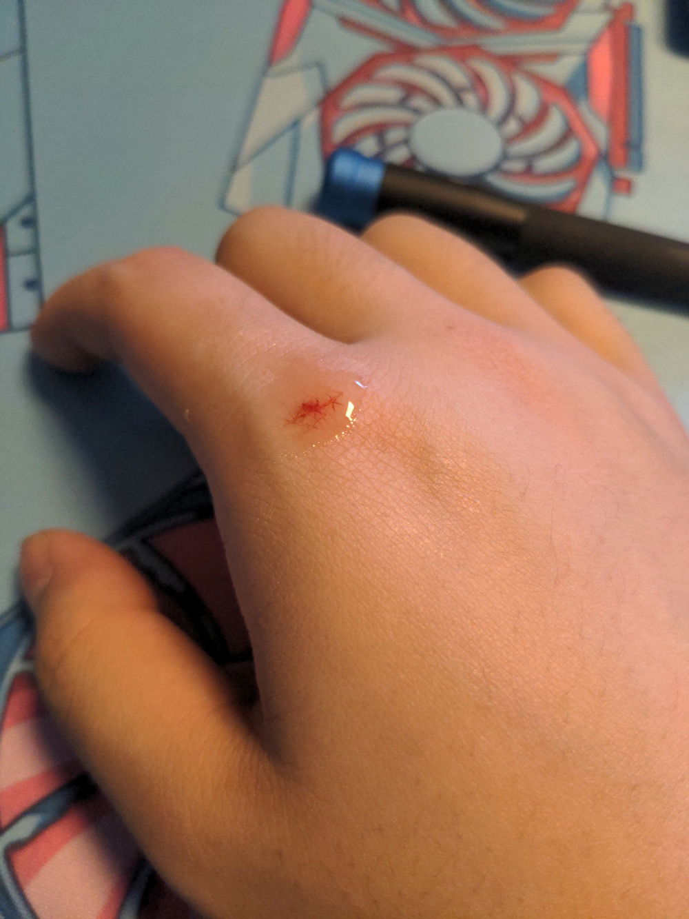 immediately busted a vein trying to take apart the pump.